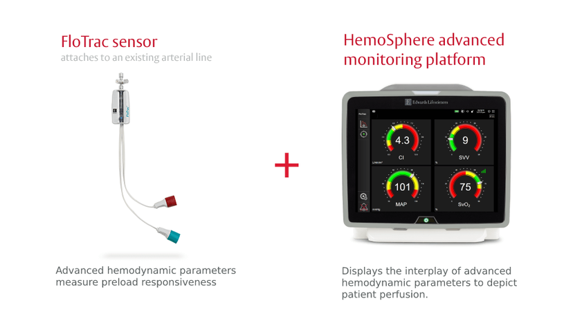 FloTrac Sensor | Edwards Lifesciences