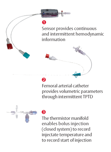 VolumeView System | Edwards Lifesciences