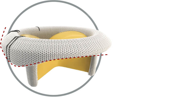 Photo of Mitral valve