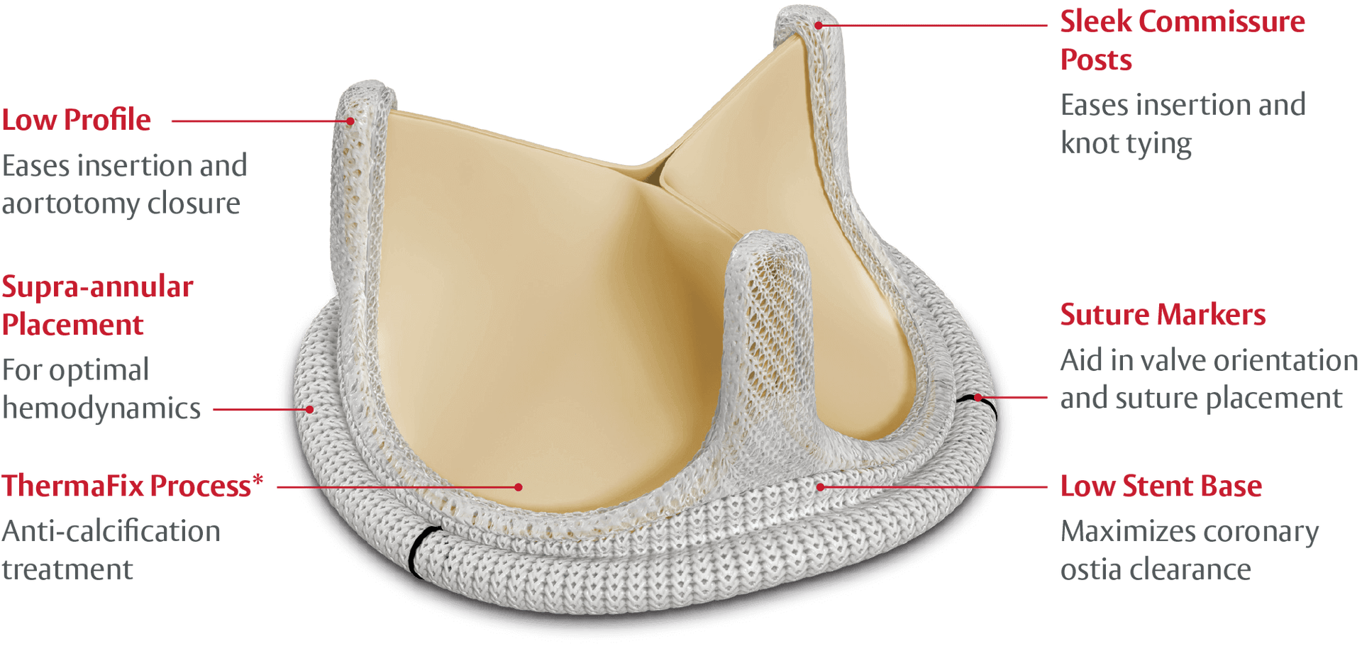 surgical-aortic-pericardial-valves-edwards-lifesciences