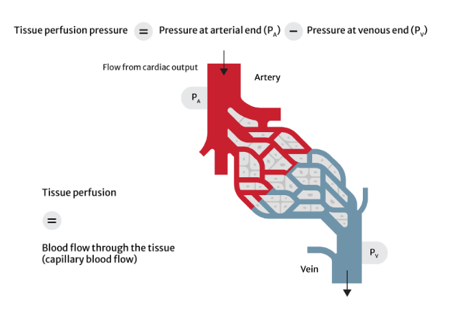 tissue perfusion
