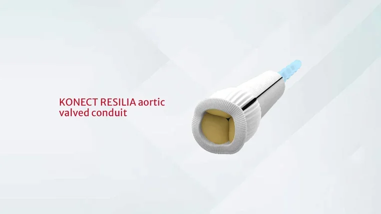 KONECT RESILIA aortic valved conduit