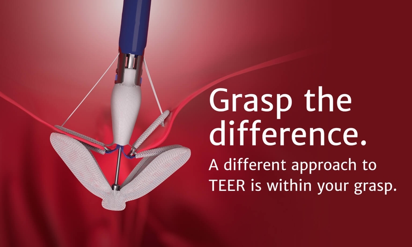 The PASCAL Precision system | Edwards Lifesciences