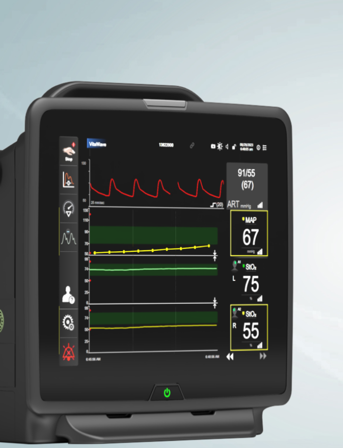 Edwards Monitor HemoSphere Vita monitor | Edwards Lifesciences