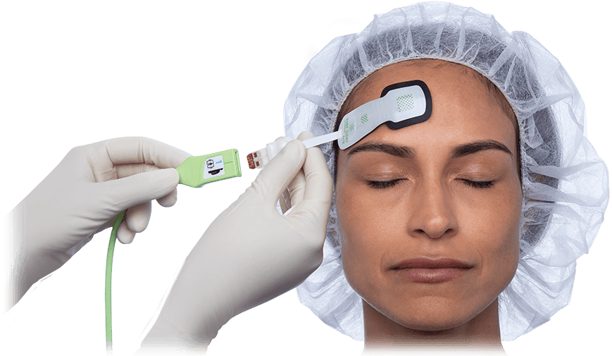 ForeSight tissue oximetry system for adults - Image
