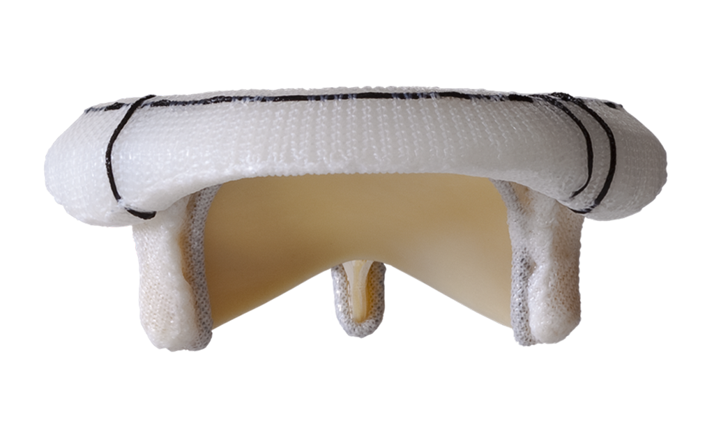 magna perimount thumbnail