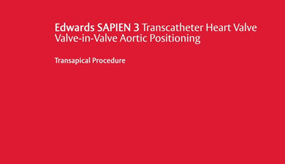 Transcatheter SAPIEN 3 TAVR gallery item 6