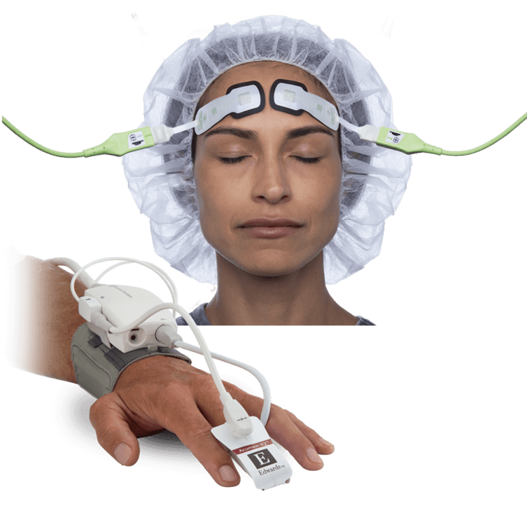 Continuous noninvasive monitoring 