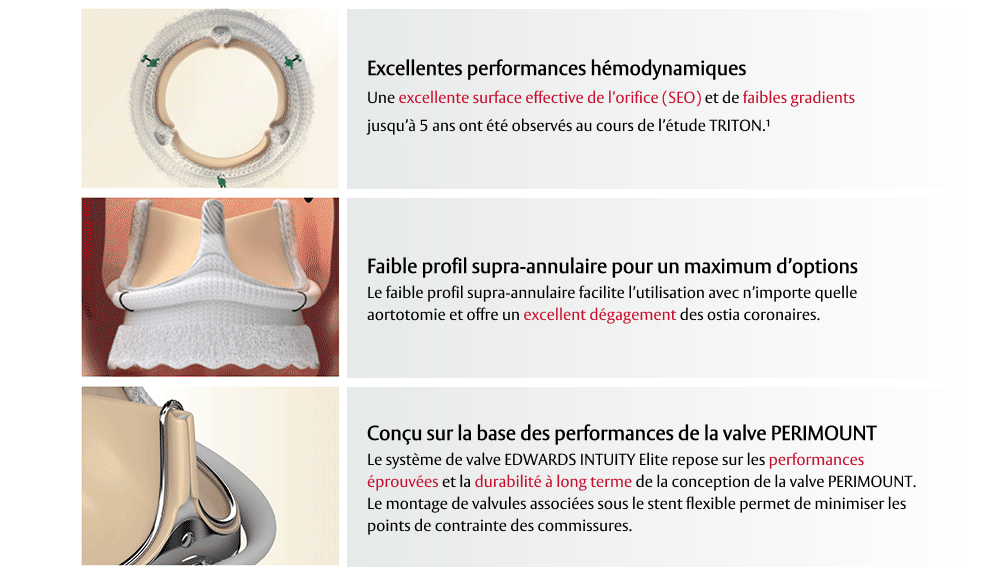 intuity features chart