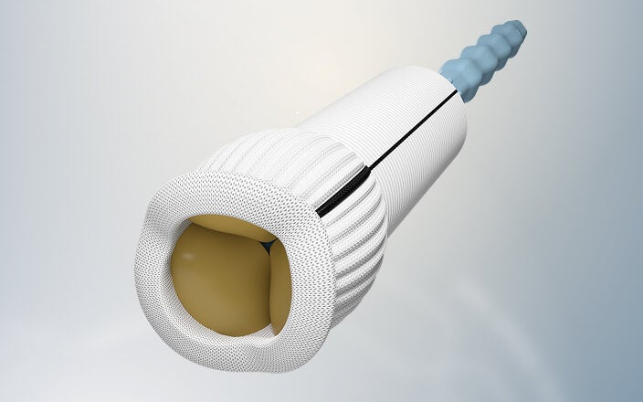 Ready to implant