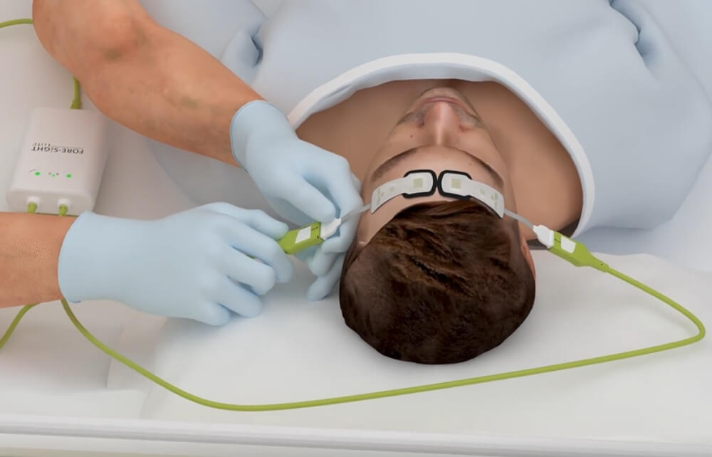 ForeSight sensor setup video