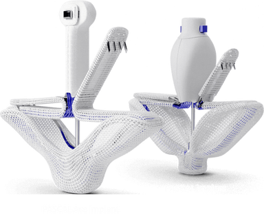 About the PASCAL implant | Edwards Lifesciences