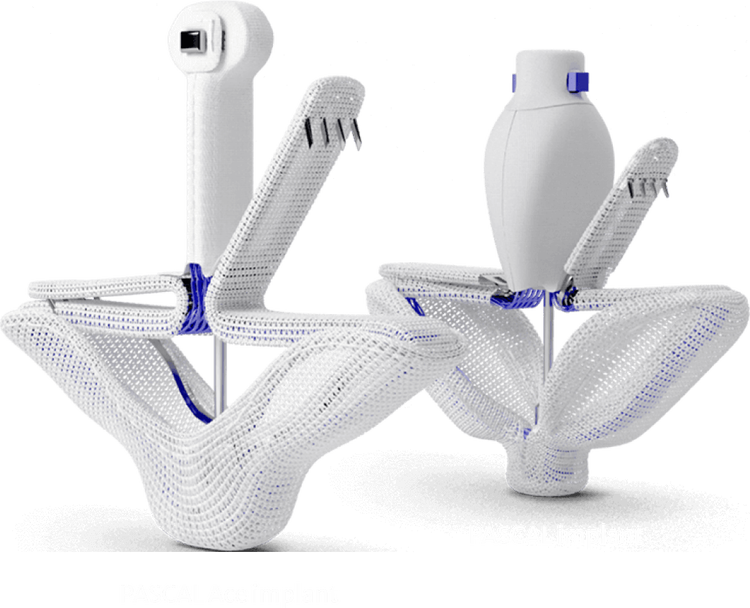 About the PASCAL implant | Edwards Lifesciences