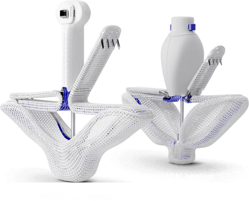 About the PASCAL implant | Edwards Lifesciences