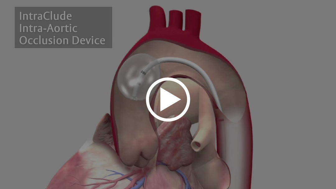 IntraClude Device Edwards Lifesciences