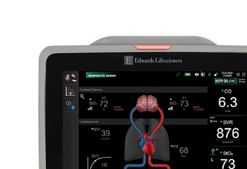 HemoSphere advaced platform image