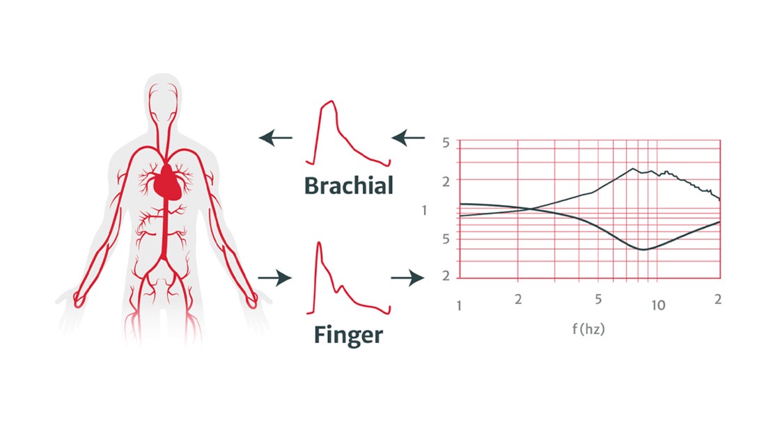 Cardiac output calculation