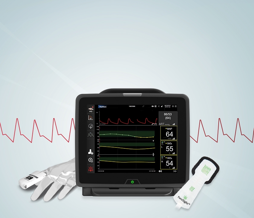 HemoSphere Vita monitor Edwards Lifesciences