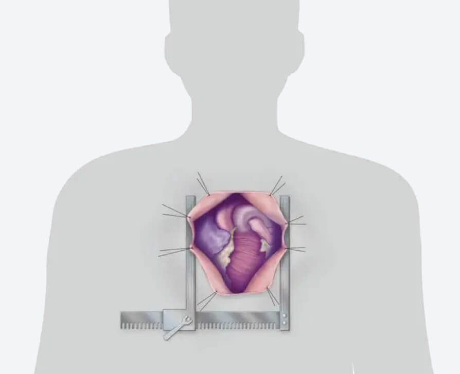 a human with heart open