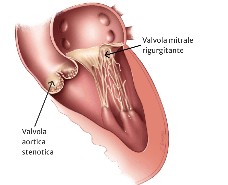 Cosa fa il cuore | Edwards Lifesciences Cosa fa il cuore | Edwards Lifesciences