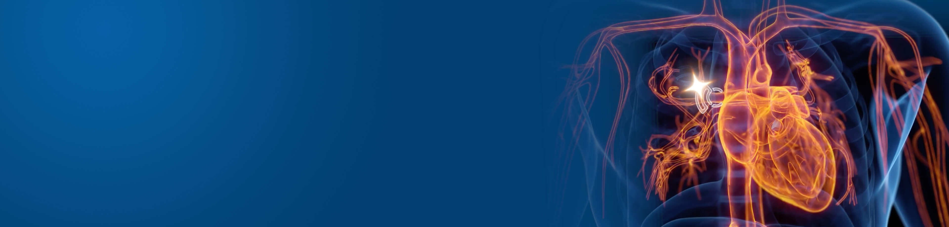 Implantable Heart Failure Management