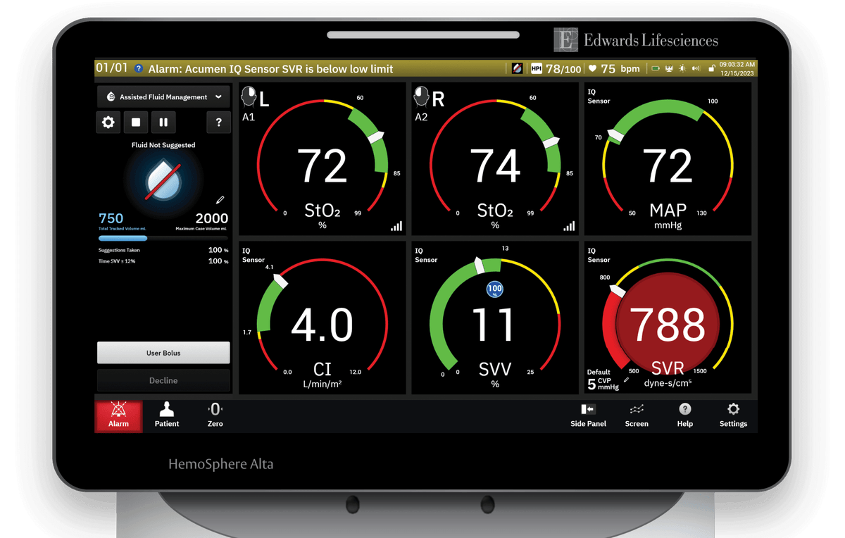 HemoSphere Alta monitor | Edwards Lifesciences