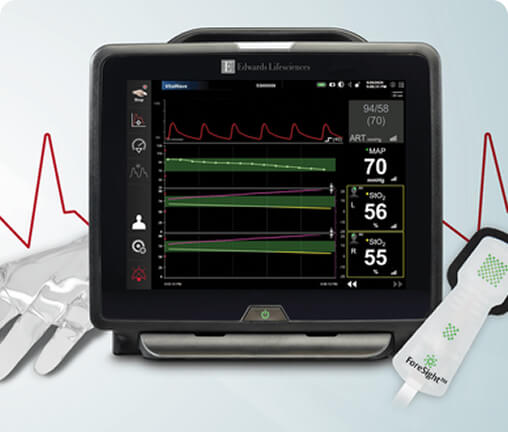 Continuous noninvasive blood pressure