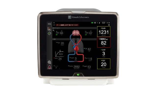 Image of HemoSphere monitor