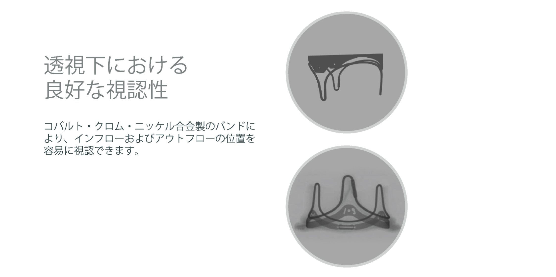 Delivering the best visibility for future interventions
