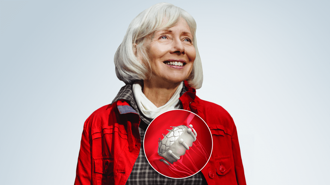 EVOQUE system and TRISCEND II image