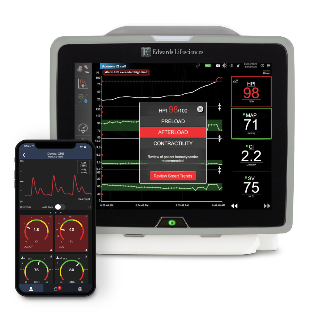 Remote Access Monitor Image