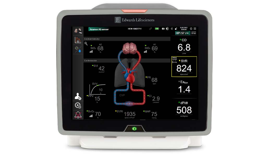 EV1000 clinical platform | Edwards Lifesciences