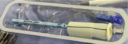 FIGURE 1 KONECT RESILIA aortic valved conduit (Edwards Lifesciences, Irvine, CA).