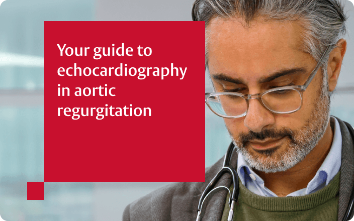 Guide to echicardiography thumbnail