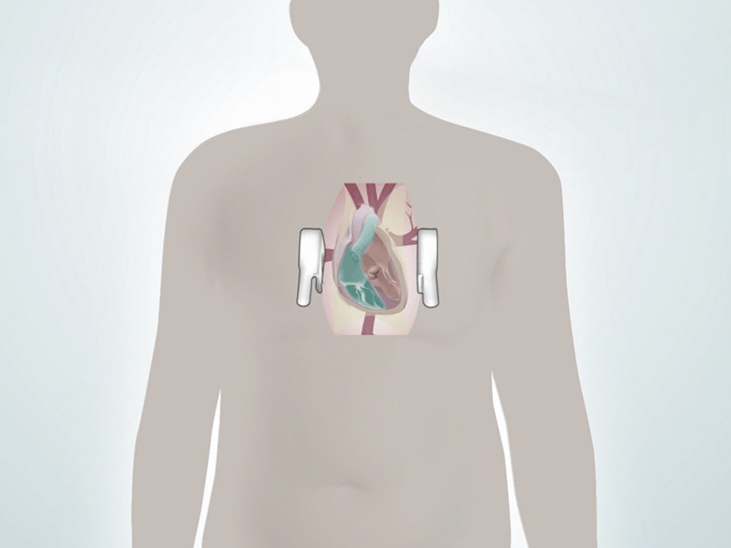 SAVR - Gallery 3 - Image