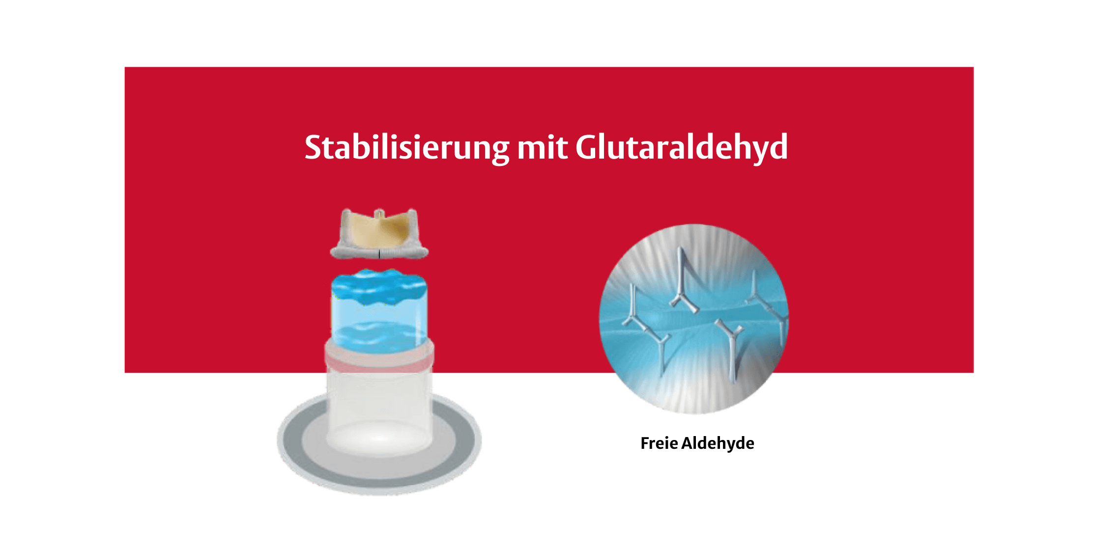 Merkmale der INSPIRIS RESILIA Klappe Edwards Lifesciences