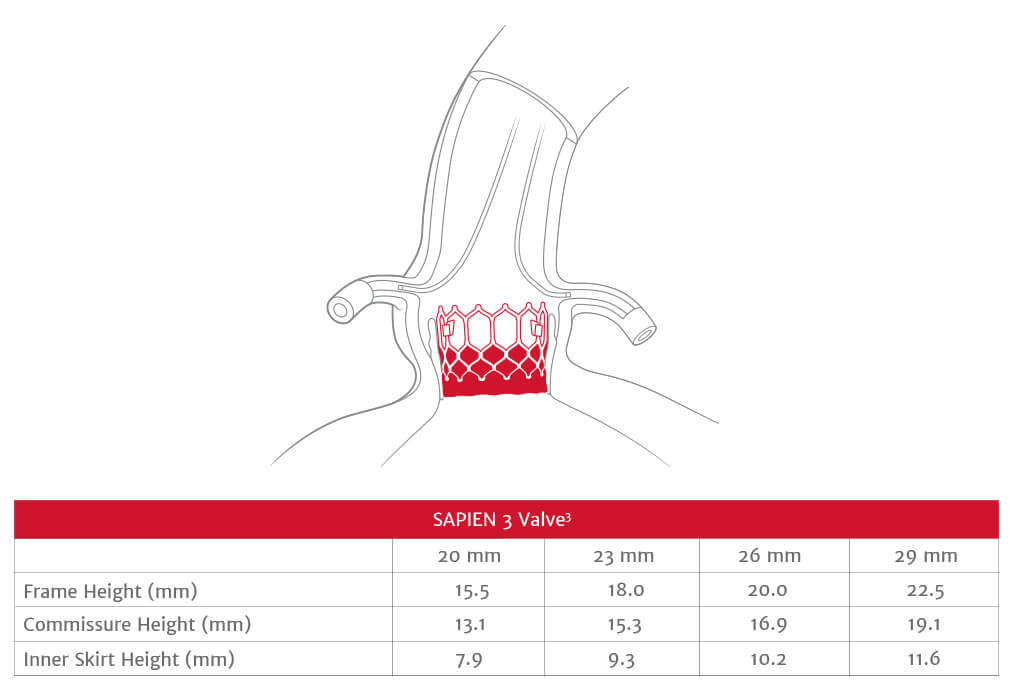 Transcatheter Aortic Valve Replacement Edwards Lifesciences