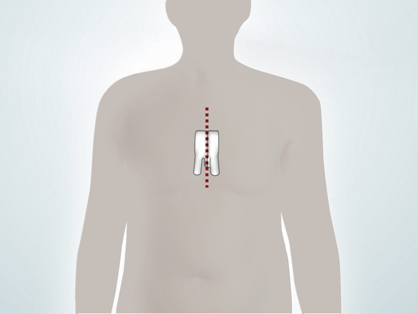 SAVR - Gallery 1 - Image