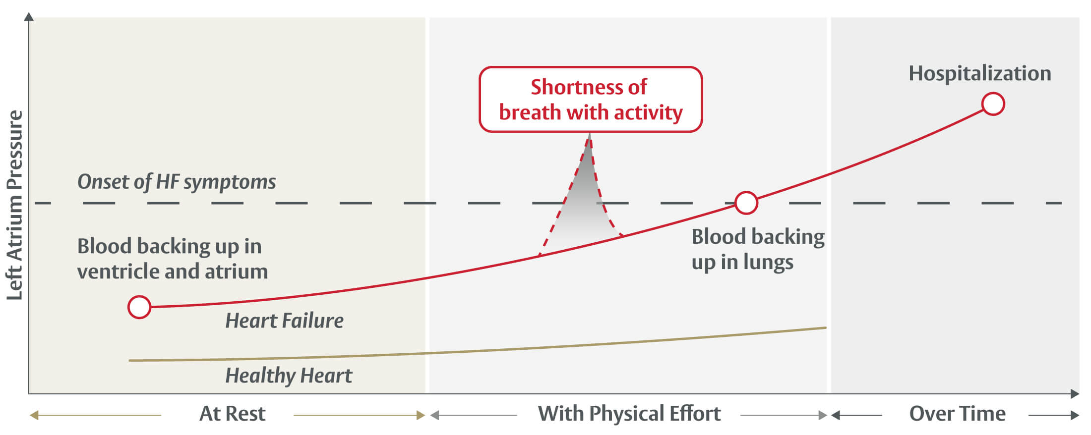 Heart failure chart