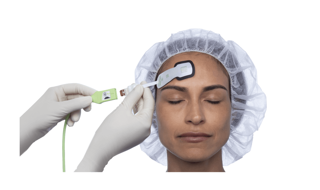 ForeSight tissue oximetry sensor