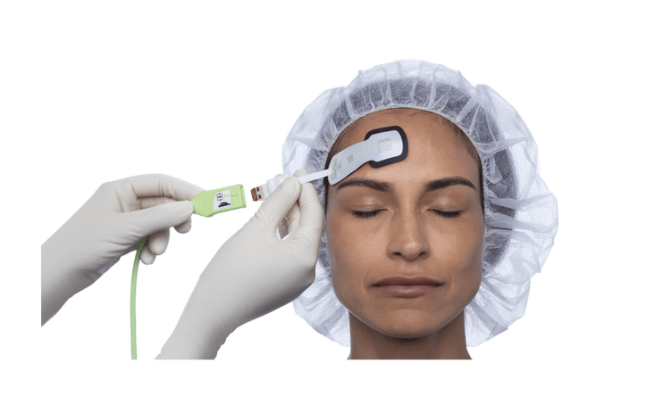 Foresight O2 Sensor Anesthesia Teams | Edwards Lifesciences
