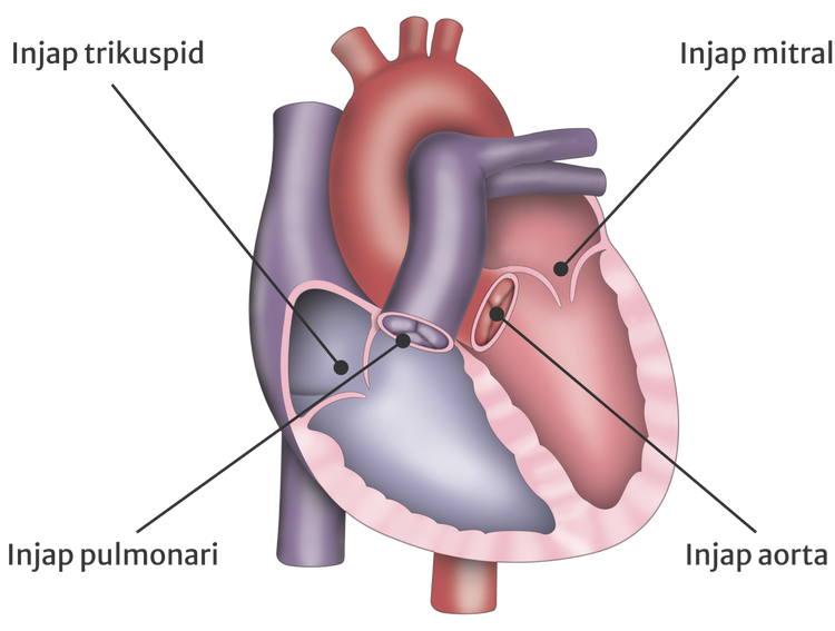 Injap Apakah penyakit injap jantung? | newheartvalve.asia