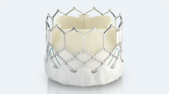 Transcatheter pulmonary valve replacement | Edwards Lifesciences