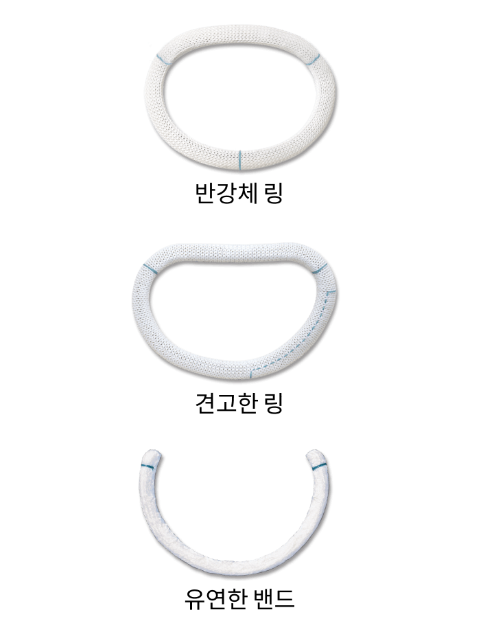 valve rings