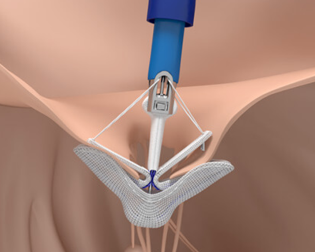 See the Clinical Evidence Image