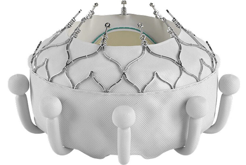transcatheter tricuspid valve