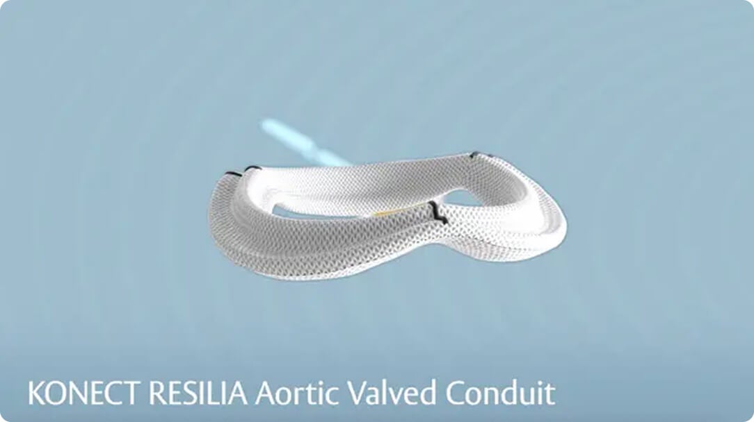 Konect RESILIA thumbnail