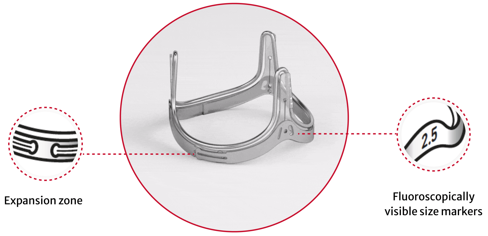 INSPIRIS RESILIA valve features | Edwards Lifesciences