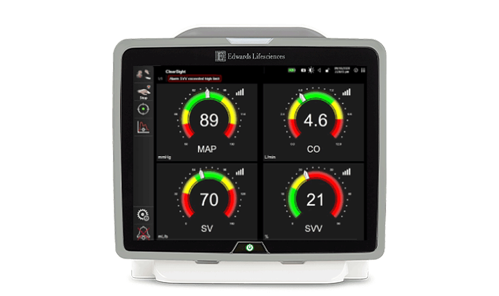 HemoSphere advanced monitoring platform