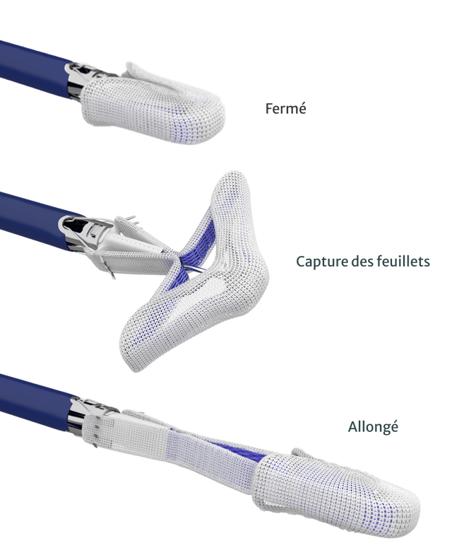 The PASCAL Precision system | Edwards Lifesciences